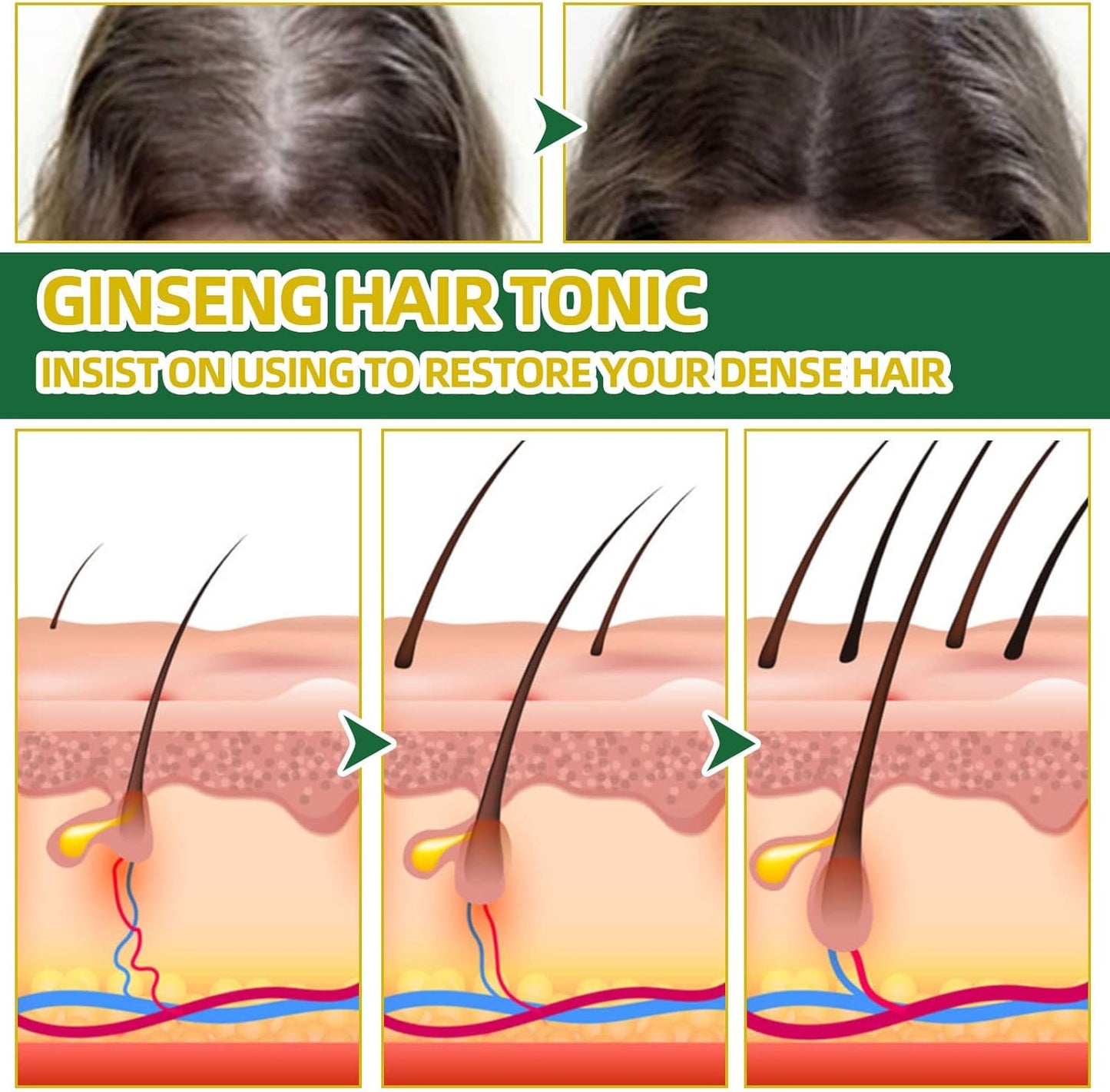 Spray de Ginseng para el Crecimiento del Cabello 100ml