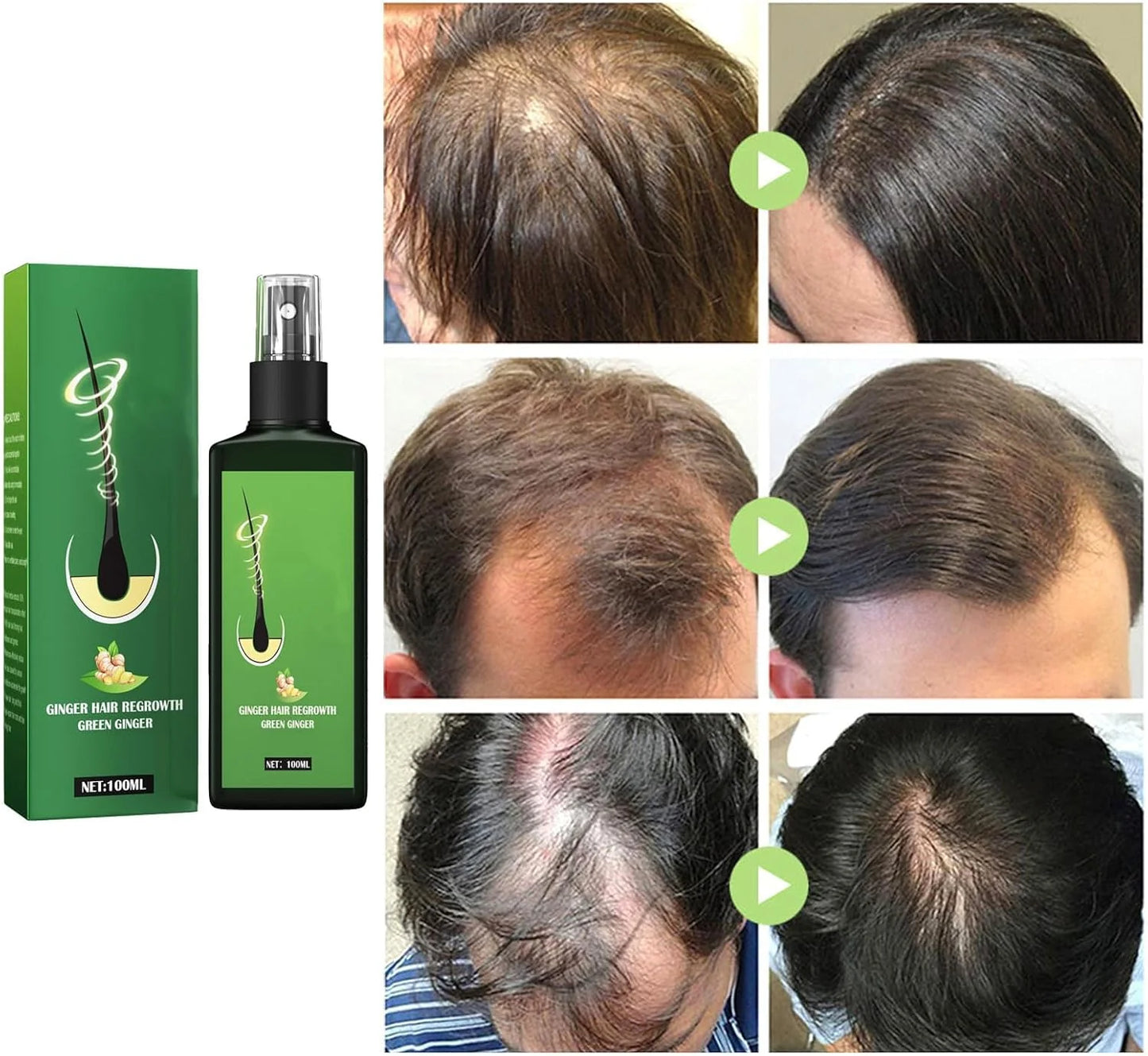 Kit: Champú para canas 500ml negro + Spray de Crecimiento del Cabello