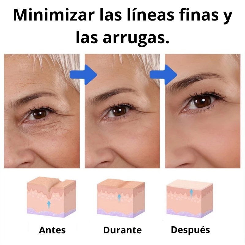 Suero Facial Botox- 2 unidades