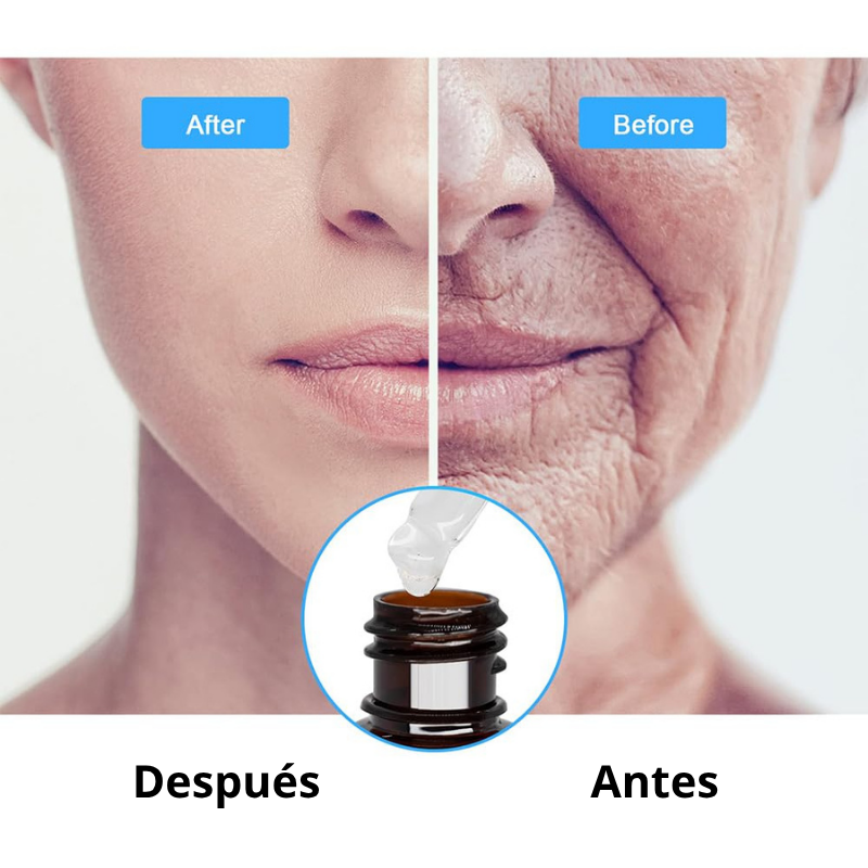 Suero Facial Botox- 2 unidades